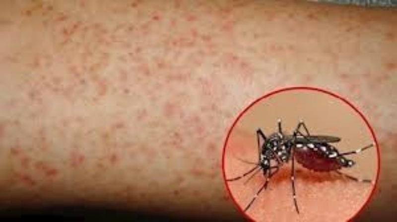 Bệnh sốt huyết do muỗi gây ra