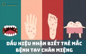 Dấu hiệu bệnh tay chân miệng ở trẻ