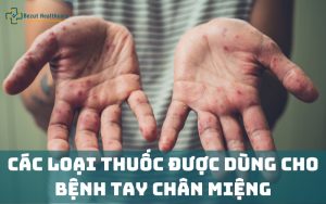 Thuốc đặc trị bệnh tay chân miệng dành cho trẻ em