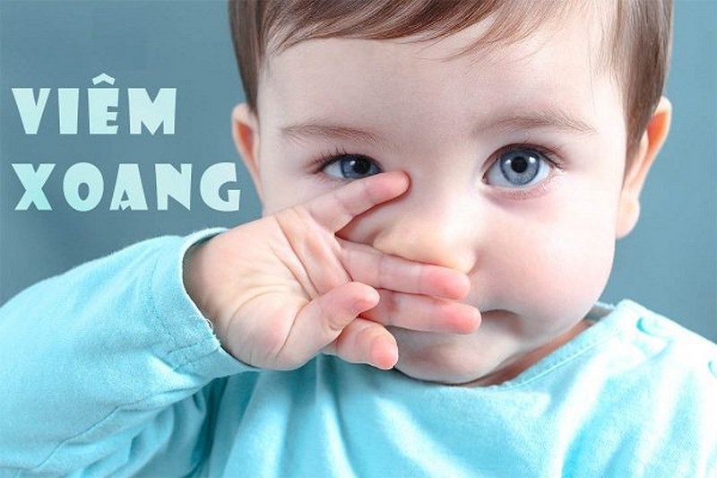 Viêm xoang dẫn tới tình trạng ho sổ mũi nhưng không số ở trẻ sơ sinh