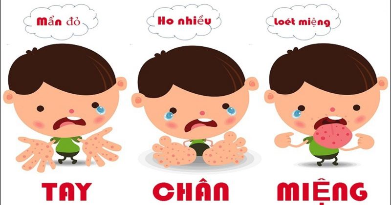 Những biểu hiện của bệnh tay chân miệng ở trẻ nhỏ